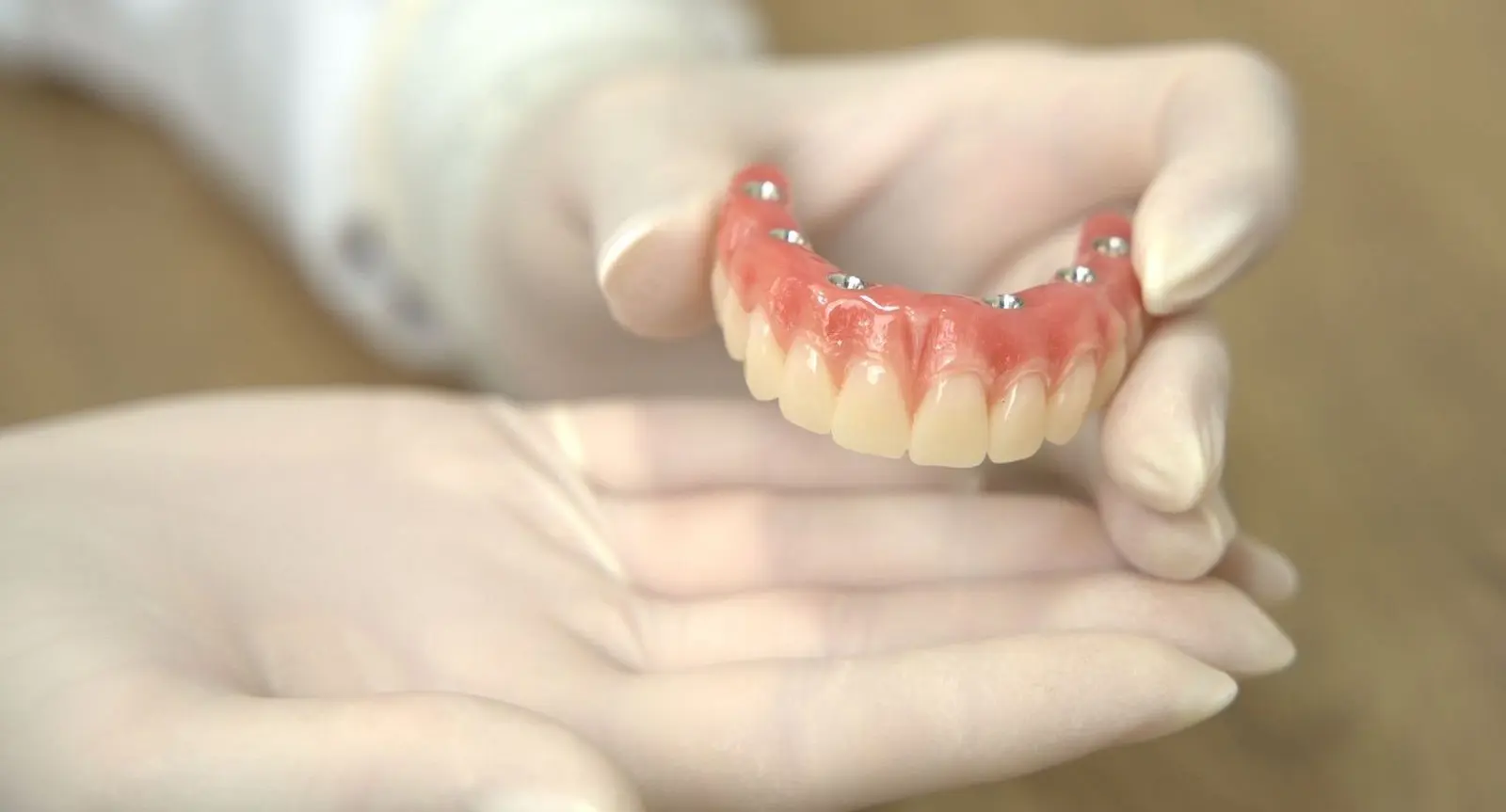 Prótese protocolo fixa sobre implantes